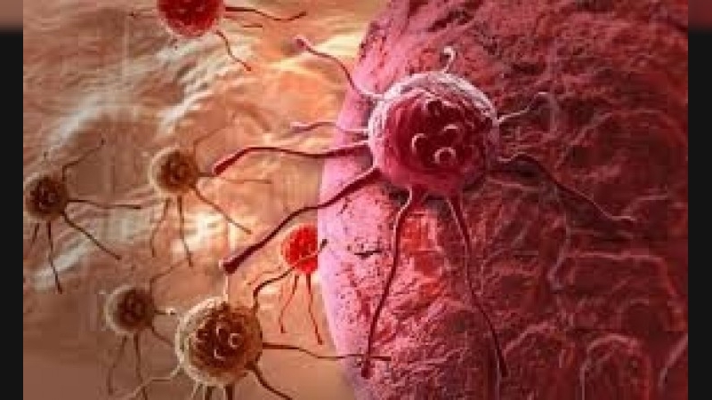 Córdoba. Aumentan los casos de cáncer en menores de 50 años