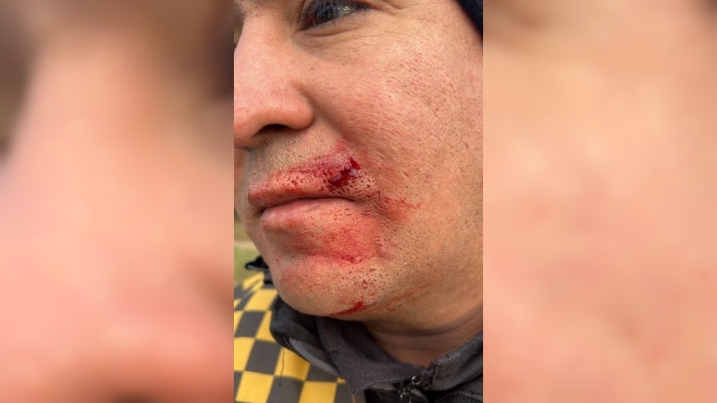 Otra brutal agresión a un policía de la Caminera en Córdoba