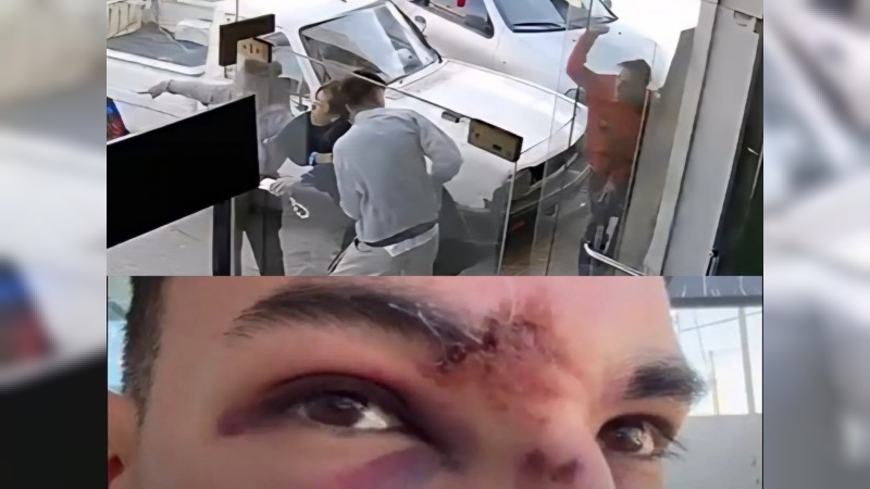Relatos salvajes en Carlos Paz: le desfiguraron la cara a golpes tras un accidente de tránsito